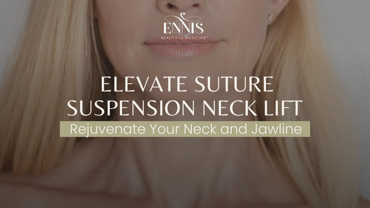 Suture Suspension Neck Lift