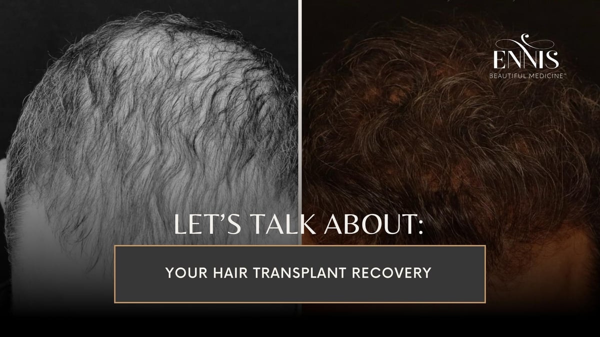 Hair Transplant Recovery & Hair Regrowth Timeline