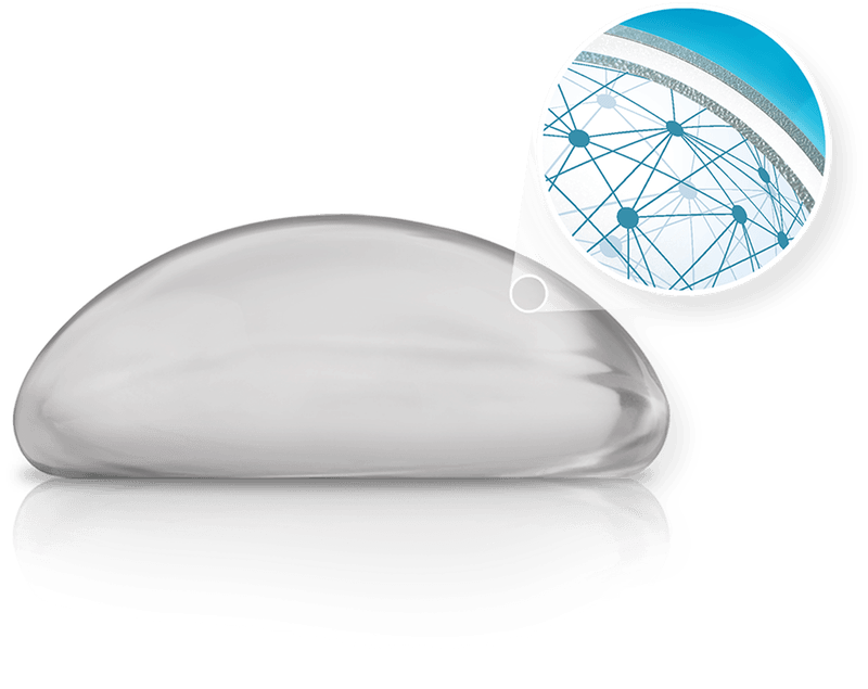 Introducing Natrelle Inspira Soft Touch Implants — accompanying illustration or photograph