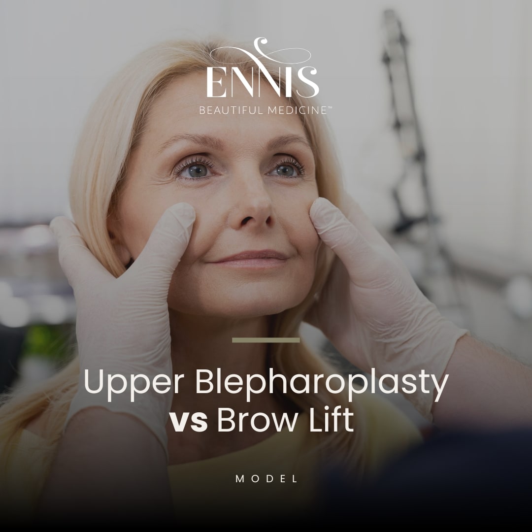 Upper Blepharoplasty vs Brow Lift. What is the Difference? — accompanying illustration or photograph