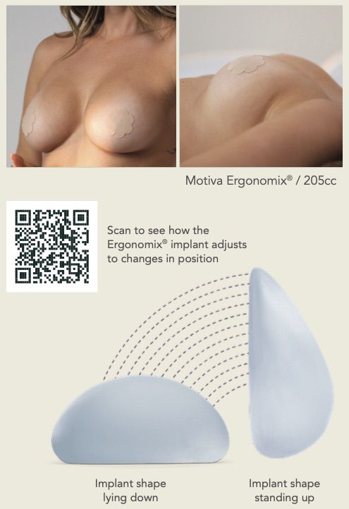 Top Breast Augmentation Options in 2026 — accompanying illustration or photograph