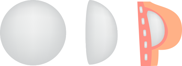 round-breast-implant-shape-profiles