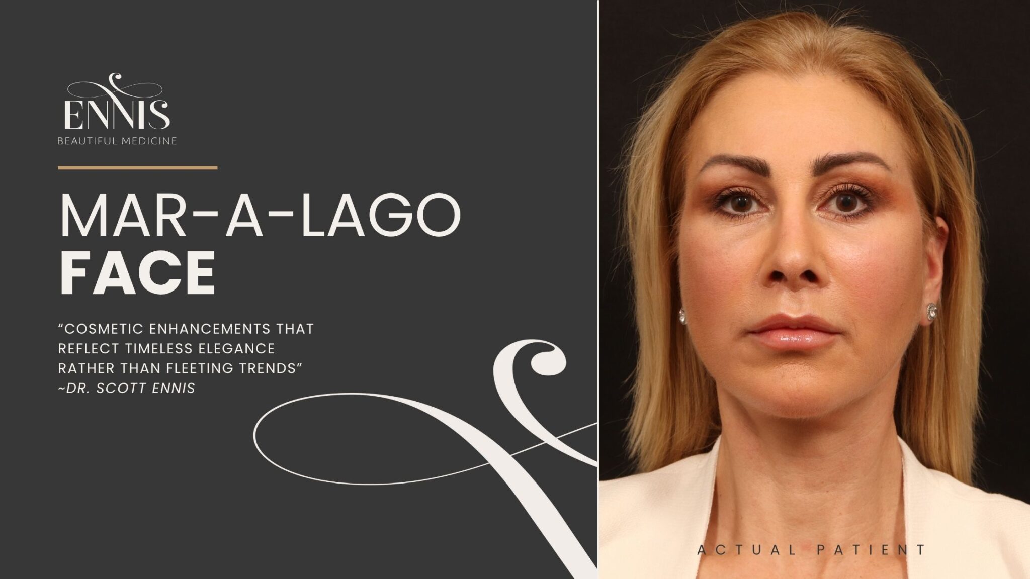 Mar-A-lago-Face-facelift-by-Dr.-Scott-En